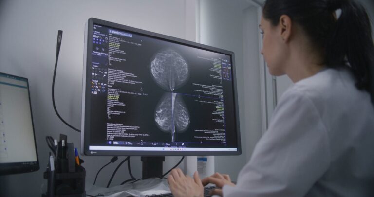 The Role of AI in Breast Cancer: From Diagnosis to Personalized Therapy