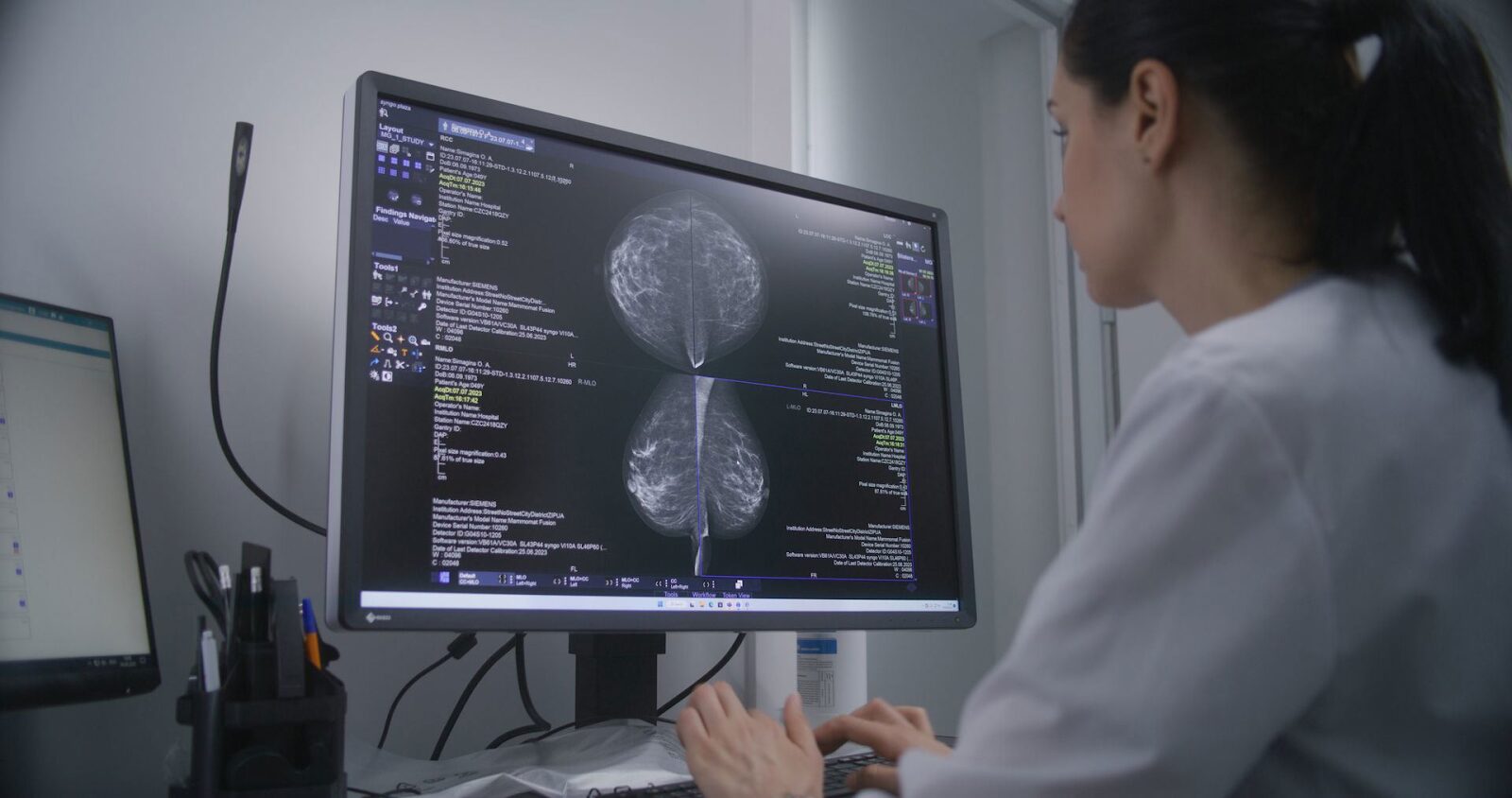 The Role of AI in Breast Cancer: From Diagnosis to Personalized Therapy
